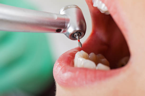 Best Knocked-Out Tooth Emergency  in Scott, LA